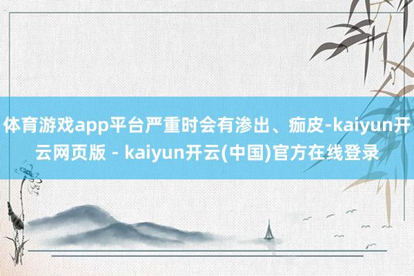 体育游戏app平台严重时会有渗出、痂皮-kaiyun开云网页版 - kaiyun开云(中国)官方在线登录